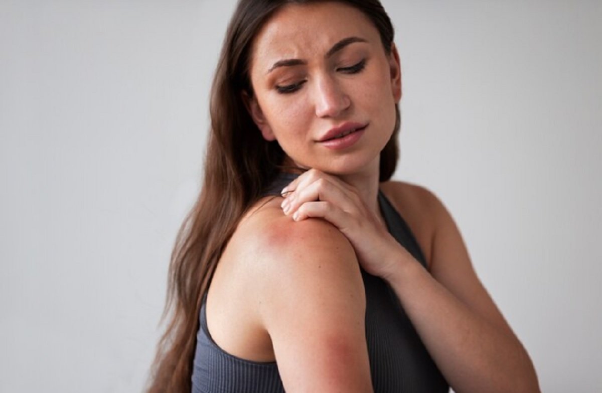 Kulit Tak Gatal Saat Hujan, Ikuti Tips Berikut ini